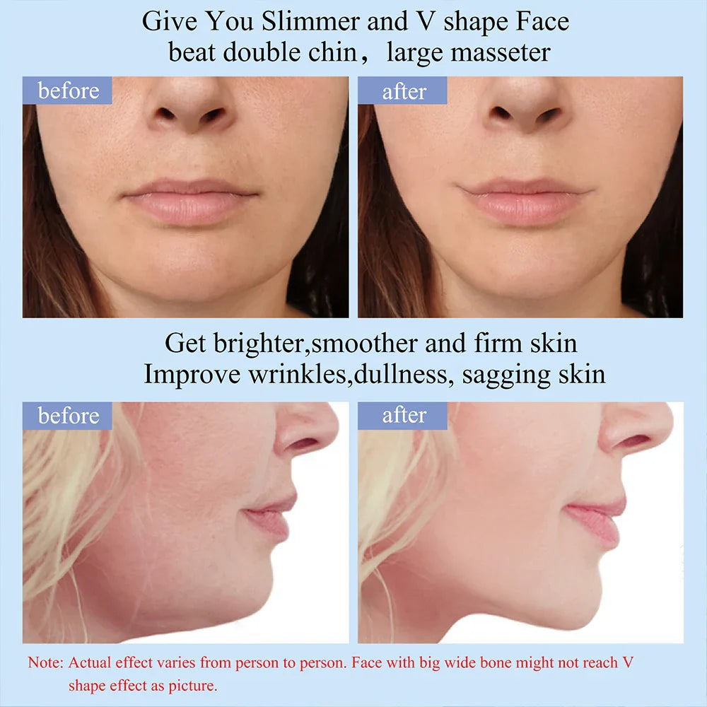 Dränerande  hudåtstramande EMS-lymfmassageapparat